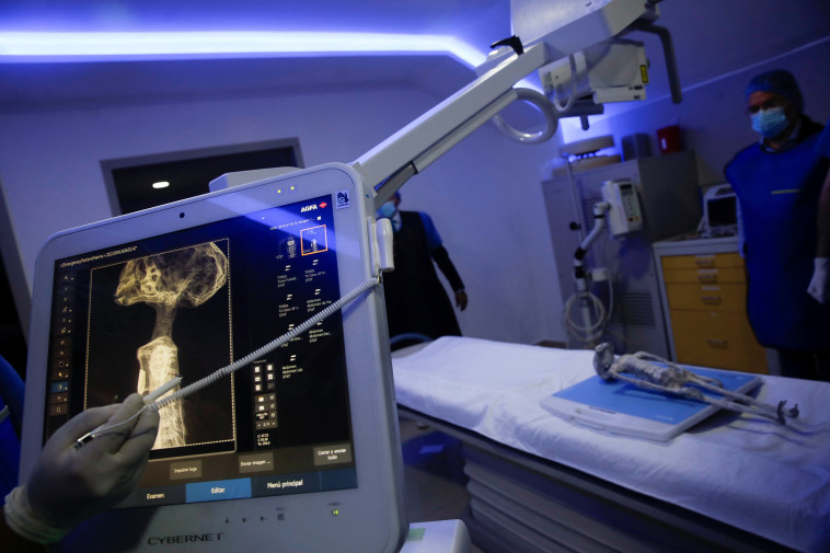 הבדיקות שנערכו ביום שני הראו תוצאות משונות