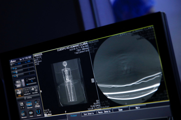  ''אני יכול לאשר שלגופות אלה אין קשר לבני האדם'', טען בניטה