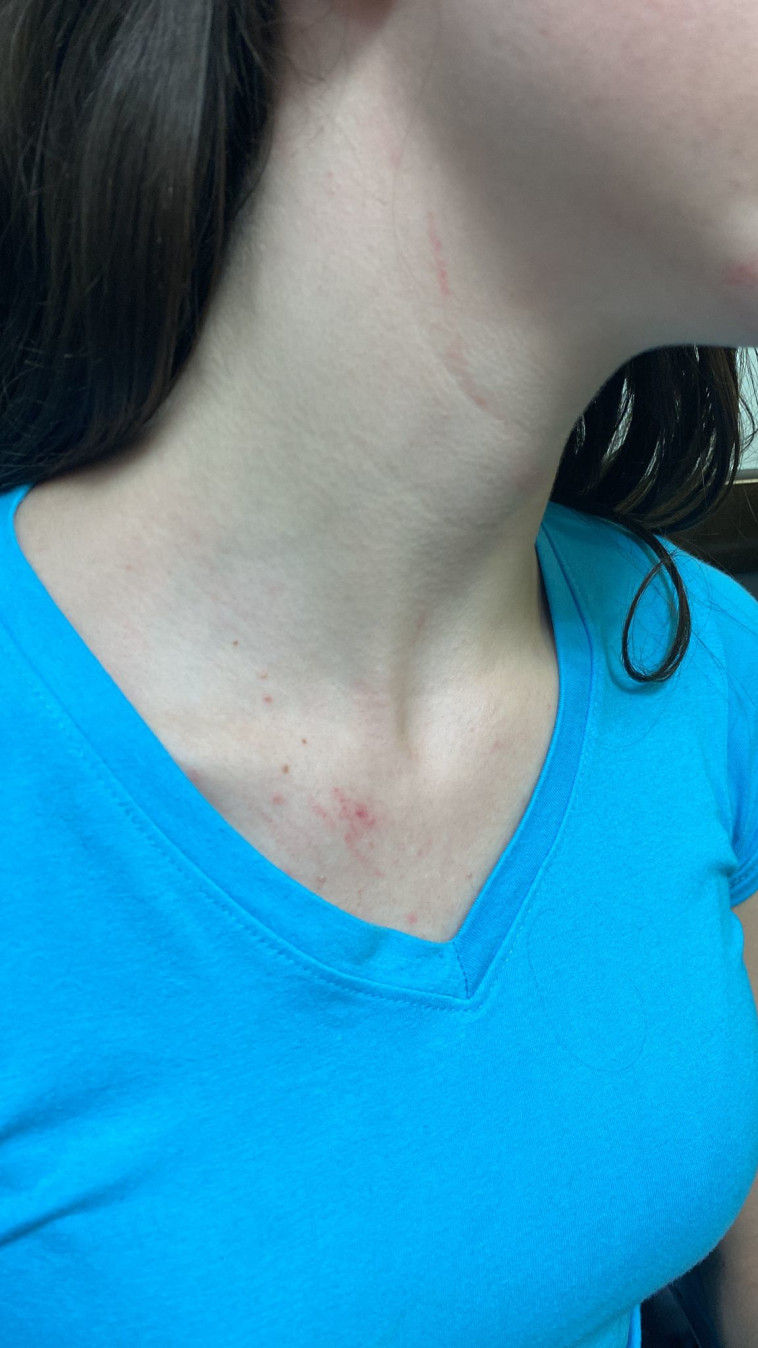 אירוע אלימות חמור בתיכון בנתניה